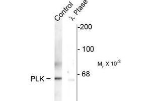 Western blots of rat synaptic membrane showing specific immunolabeling of the ~66 k PLK protein phosphorylated at Thr210 (control). (PLK1 Antikörper  (pThr210))