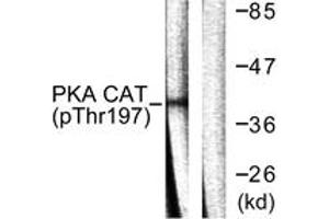 Western blot analysis of extracts from mouse brain, using PKA CAT (Phospho-Thr197) Antibody. (PKA CAT (AA 166-215), (pThr198) Antikörper)