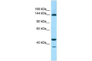 WB Suggested Anti-TBC1D4 Antibody Titration: 1. (TBC1D4 Antikörper  (C-Term))