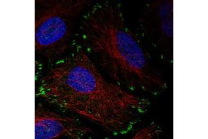 Immunofluorescent staining of HeLa cells with ZYX monoclonal antibody, clone CL2502  (Green) shows distinct focal adhesion. (ZYX Antikörper)