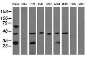 Image no. 2 for anti-Quinolinate Phosphoribosyltransferase (QPRT) antibody (ABIN1500533)