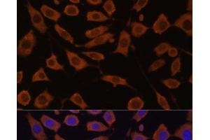 Immunofluorescence analysis of L929 cells using STUB1 Polyclonal Antibody at dilution of 1:100 (40x lens). (STUB1 Antikörper)