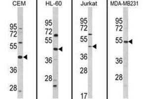 Western blot analysis of PTAR1 Antibody (Center) from left to right in CEM, HL-60, Jurkat, MDA-MB231 cell line lysates (35ug/lane).