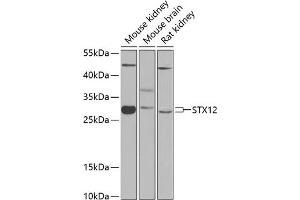Western blot analysis of extracts of various cell lines, using STX12 antibody (ABIN6128798, ABIN6148655, ABIN6148656 and ABIN6224224) at 1:1000 dilution. (Syntaxin 12 Antikörper  (AA 1-250))