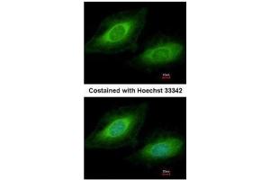 ICC/IF Image Immunofluorescence analysis of methanol-fixed HeLa, using TSSC1, antibody at 1:200 dilution. (TSSC1 Antikörper  (Center))