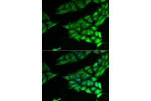 Immunofluorescence analysis of U2OS cells using PSAT1 antibody. (PSAT1 Antikörper  (AA 1-370))