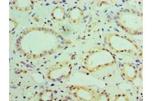 Immunohistochemistry (IHC) image for anti-NADH Dehydrogenase (Ubiquinone) 1 beta Subcomplex, 7, 18kDa (NDUFB7) (AA 2-137) antibody (ABIN7160933)