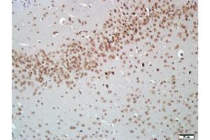 Paraformaldehyde-fixed, paraffin embedded Mouse brain, Antigen retrieval by boiling in sodium citrate buffer (pH6. (AKT2 Antikörper  (AA 101-200))