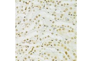 Immunohistochemistry (Paraffin-embedded Sections) (IHC (p)) image for anti-Adenosine Deaminase, RNA-Specific (ADAR) (AA 150-250) antibody (ABIN6136553)