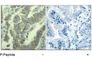 Image no. 1 for anti-Myristoylated Alanine-Rich Protein Kinase C Substrate (MARCKS) (pSer170) antibody (ABIN401558) (MARCKS Antikörper  (pSer170))