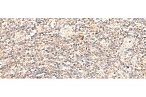 Immunohistochemistry of paraffin-embedded Human tonsil tissue using TRAPPC1 Polyclonal Antibody at dilution of 1:50(x200) (TRAPPC1 Antikörper)