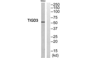 Western blot analysis of extracts from COLO205 cells, using TIGD3 antibody. (TIGD3 Antikörper  (C-Term))