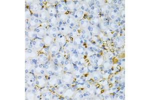 Immunohistochemistry of paraffin-embedded mouse kidney using TAPBP Antibody. (TAPBP Antikörper)