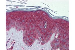 Immunohistochemistry (IHC) image for anti-Peroxiredoxin 6 (PRDX6) (C-Term) antibody (ABIN2783305) (Peroxiredoxin 6 Antikörper  (C-Term))