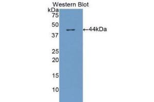 Western Blotting (WB) image for anti-Complement Factor H (CFH) (AA 860-1231) antibody (ABIN3208200) (Complement Factor H Antikörper  (AA 860-1231))