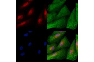 ABIN6258869 and ABIN6273723 staining  cells by IF/ICC. (KLF12 Antikörper  (Internal Region))