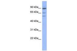 Image no. 1 for anti-Tripartite Motif Containing 50 (TRIM50) (AA 395-444) antibody (ABIN6742937) (TRIM50 Antikörper  (AA 395-444))