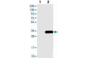 Western blot analysis of Lane 1: Negative control (vector only transfected HEK293T lysate), Lane 2: Over-expression Lysate (Co-expressed with a C-terminal myc-DDK tag (~3. (SLC25A10 Antikörper)