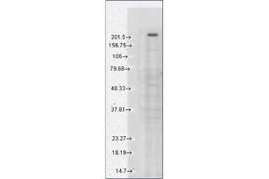 Western Blotting (WB) image for anti-Transient Receptor Potential Cation Channel, Subfamily M, Member 7 (TRPM7) (AA 1817-1863), (C-Term) antibody (ABIN452417) (TRPM7 Antikörper  (C-Term))