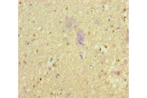 Immunohistochemistry of paraffin-embedded human brain tissue using ABIN7161659 at dilution of 1:100 (NMDA Receptor Synaptonuclear Signaling and Neuronal Migration Factor (NSMF) (AA 251-530) Antikörper)