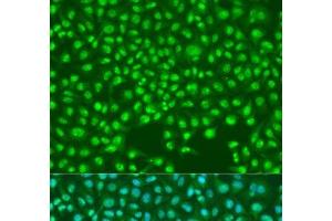 Immunofluorescence analysis of U2OS cells using SKP2 Polyclonal Antibody at dilution of 1:100. (SKP2 Antikörper)