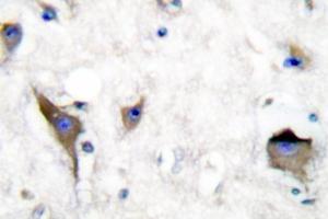 Image no. 1 for anti-PTK2B Protein tyrosine Kinase 2 beta (PTK2B) antibody (ABIN271797) (PTK2B Antikörper)