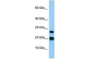 Host: Rabbit Target Name: BTF3L4 Sample Type: MCF7 Whole Cell lysates Antibody Dilution: 1. (BTF3L4 Antikörper  (C-Term))