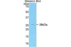 Western blot analysis of the recombinant protein. (IRAK3 Antikörper  (AA 201-410))