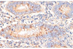 Immunohistochemistry of paraffin-embedded Human appendix using WNK3 Polyclonal Antibody at dilution of 1:100 (40x lens). (WNK3 Antikörper)