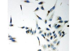 ICC testing of NOX5 antibody and HeLa cells (NOX5 Antikörper  (C-Term))