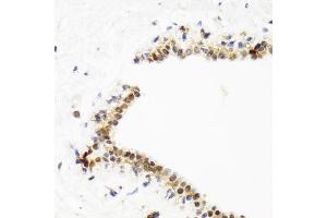 Immunohistochemistry of paraffin-embedded human breast using TOP1 antibody. (Topoisomerase I Antikörper)