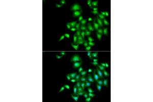 Immunofluorescence analysis of  cells using IL20 antibody (ABIN6128133, ABIN6142353, ABIN6142354 and ABIN6222322). (IL-20 Antikörper  (AA 25-176))