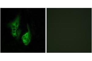 Immunofluorescence analysis of HeLa cells, using OPN5 Antibody. (OPN5 Antikörper  (AA 251-300))