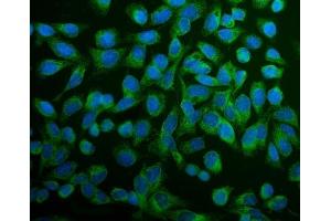 anti-Protein Disulfide Isomerase Family A, Member 6 (PDIA6) (AA 20-440) antibody