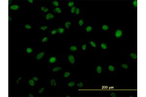 Immunofluorescence of monoclonal antibody to ZNF207 on HeLa cell. (ZNF207 Antikörper  (AA 1-110))