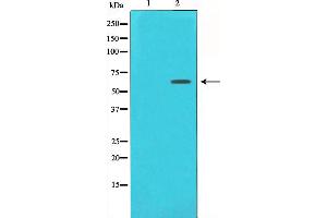 Western blot analysis of Estrogen Receptor-alpha expression in 293 whole cell lysates,The lane on the left is treated with the antigen-specific peptide. (Estrogen Receptor alpha Antikörper  (C-Term))