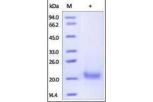 SDS-PAGE (SDS) image for Tumor Necrosis Factor Receptor Superfamily, Member 10a (TNFRSF10A) (AA 24-239) protein (His tag) (ABIN2181862)
