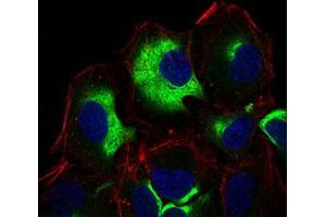 Immunofluorescent staining of HeLa cells using IL3RA monoclonal antibody, clone 10B8E7 . (IL3RA Antikörper)