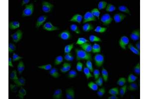 Immunofluorescence staining of Hela cells with ABIN7175586 at 1:266, counter-stained with DAPI. (CACNA1C Antikörper  (AA 1755-1971))