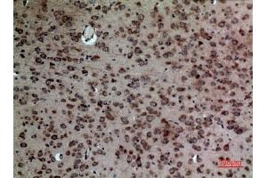 Immunohistochemical analysis of paraffin-embedded Mouse-brain, antibody was diluted at 1:100.