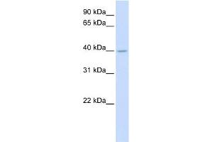 SRD5A3 antibody used at 1 ug/ml to detect target protein. (SRD5A3 Antikörper  (N-Term))