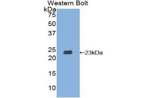 Western blot analysis of the recombinant protein. (SIT1 Antikörper  (AA 2-175))