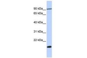 Image no. 1 for anti-Transmembrane 4 Superfamily Member 4 (TM4SF4) (N-Term) antibody (ABIN6740976) (TM4SF4 Antikörper  (N-Term))