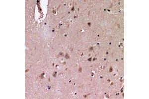 Immunohistochemical analysis of Cadherin 20 staining in human brain formalin fixed paraffin embedded tissue section.