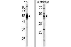 (LEFT) Western blot analysis of PDIA6 antibody (Center K159) in Y79 cell line lysates (35ug/lane). (PDIA6 Antikörper  (Middle Region))