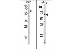 Image no. 1 for anti-Cytochrome P450, Family 1, Subfamily A, Polypeptide 1 (CYP1A1) (AA 384-414), (C-Term) antibody (ABIN360413) (CYP1A1 Antikörper  (C-Term))