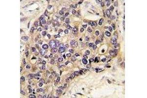 Immunohistochemistry (IHC) image for anti-Hepatocyte Growth Factor (Hepapoietin A, Scatter Factor) (HGF) (AA 521-554) antibody (ABIN3031186)