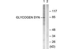 Western blot analysis of extracts from HeLa cells, treated with Serum 20% 30', using Glycogen Synthase (Ab-645) Antibody. (Glycogen Synthase Antikörper  (AA 621-670))