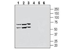 Western blot analysis of human THP-1 monocytic leukemia cell line lysate (lanes 1 and 4), human NK-92 natural killer cell line lysate (lanes 2 and 5) and human HL-60 promyelocytic leukemia cell line lysate (lanes 3 and 6) lysates: - 1-3. (S1PR5 Antikörper  (Extracellular, N-Term))