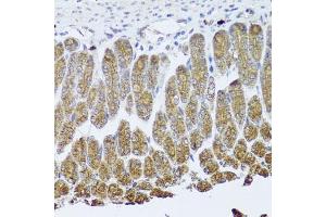 Immunohistochemistry of paraffin-embedded mouse stomach using NTRK1 Antibody (ABIN5971124) at dilution of 1/100 (40x lens). (TRKA Antikörper)